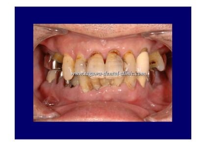 歯周病治療に関するイメージ写真（診査・診断風景）