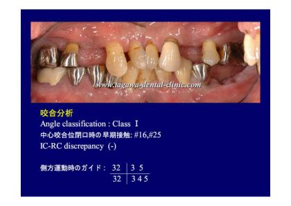 歯周病治療に関するイメージ写真（検査・カウンセリング）