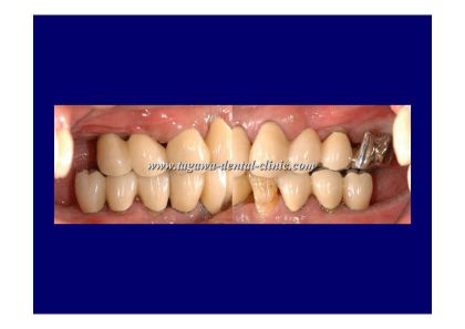 歯周治療の説明を行う様子（イメージ写真）
