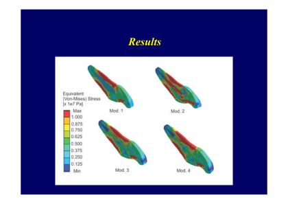 神経を失った歯と補強材料に関するイメージ図