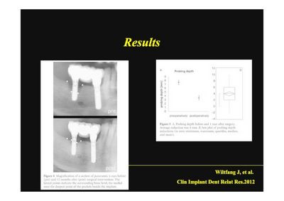 implant-regeneration_2_page025.jpg