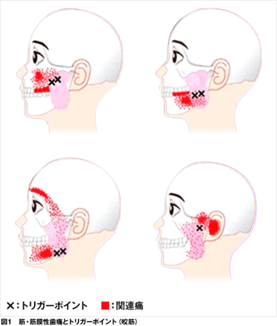 toothache-fromother01.gif