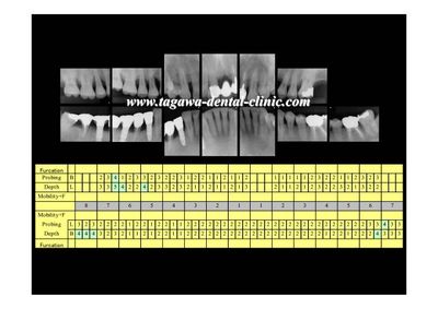 治療後のイメージ写真