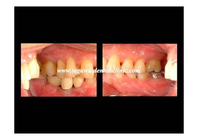 治療後のイメージ写真