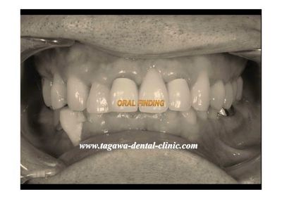 症例紹介の写真3