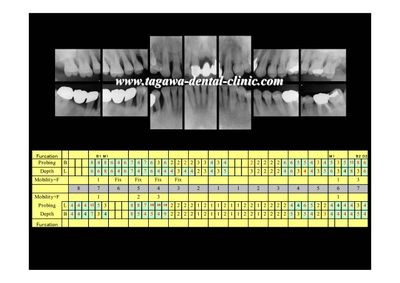 術前分析のイメージ写真