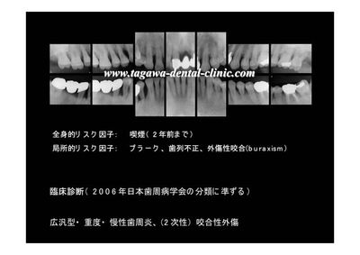 術前分析のイメージ写真