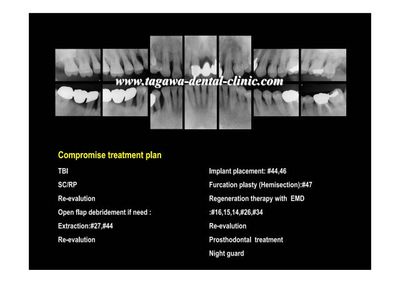 治療計画説明のイメージ写真