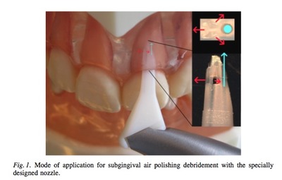 ペリオフロー機器の外観イメージ