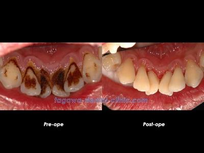 PMTCで使用される器具のイメージ写真