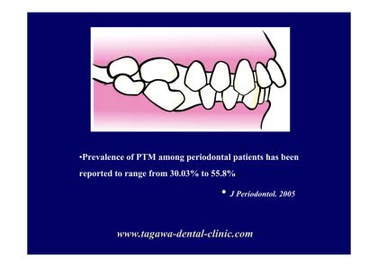 tooth-migration.jpg